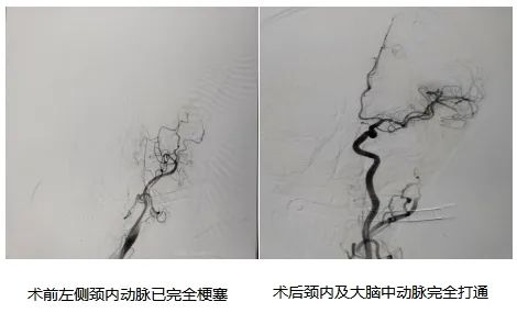 危命之栓，取之有道